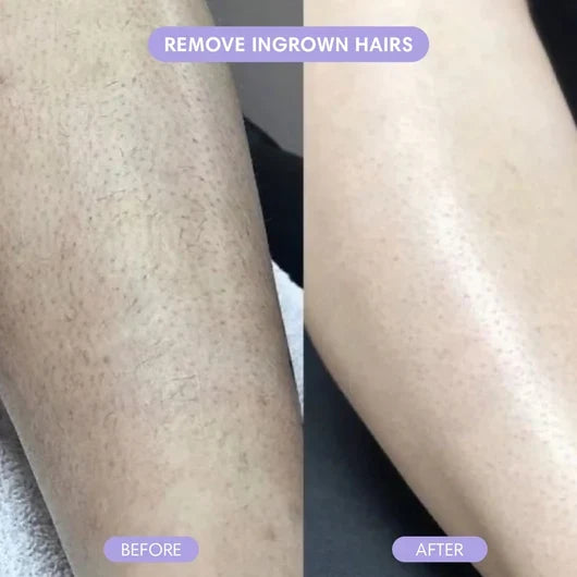 Divifit Bikini Pain-Free Hair Removal Cream for Sensitive Skin