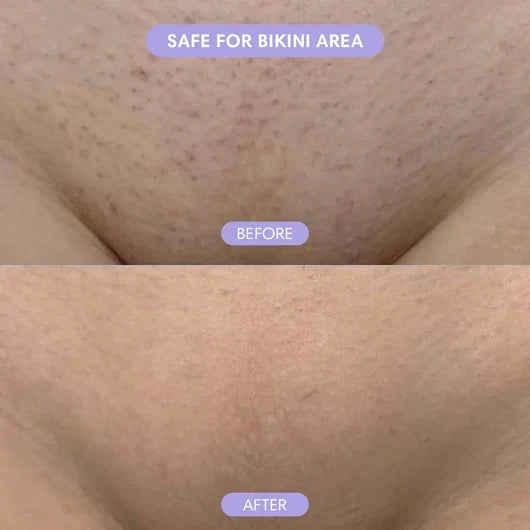 Divifit Bikini Pain-Free Hair Removal Cream for Sensitive Skin