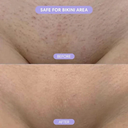 Divifit Bikini Pain-Free Hair Removal Cream for Sensitive Skin